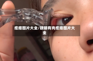 疙瘩图片大全/眼睛有肉疙瘩图片大全